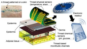 智能縫合技術 實時監控傷口恢復狀態并連接手機的新突破